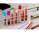   Untersuchung, Labor, Blutprobe, Coronavirus